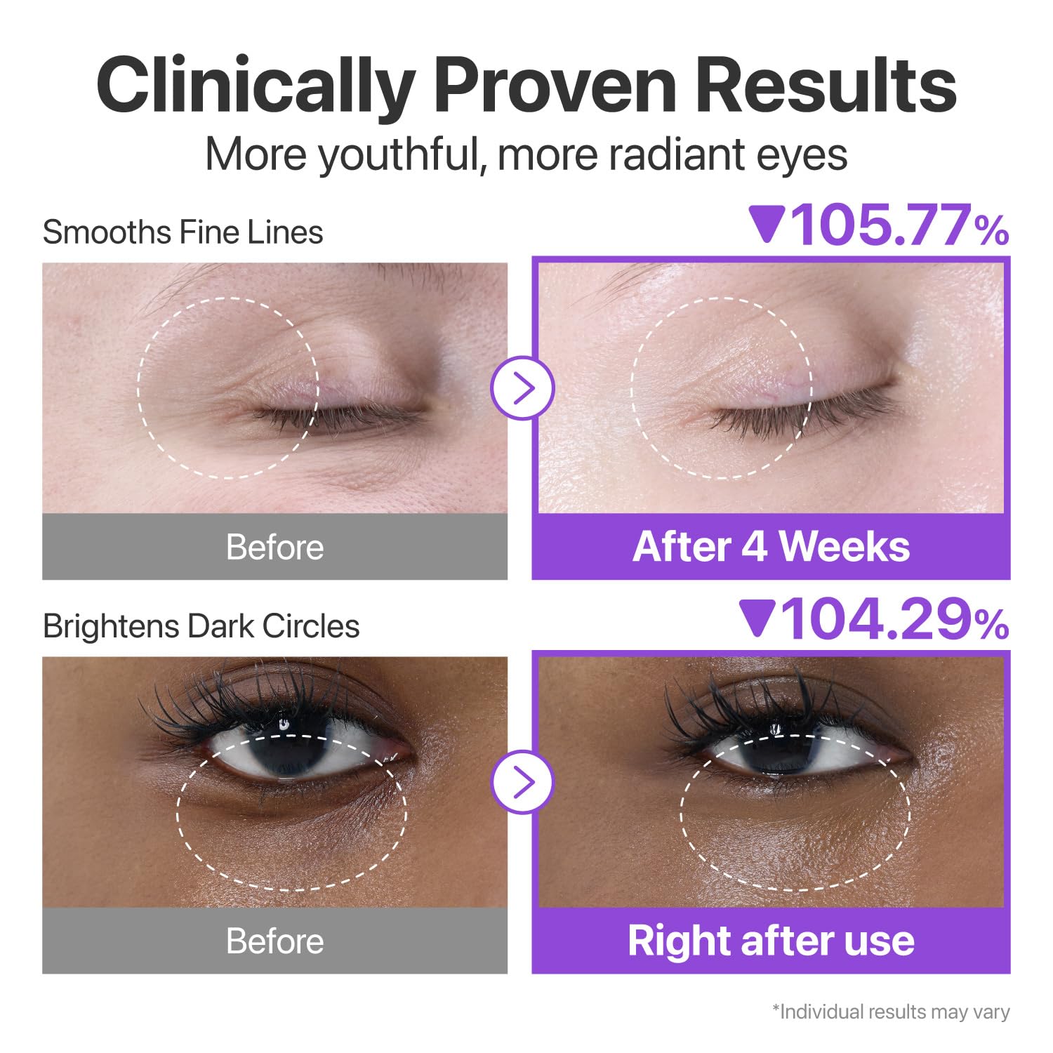 numbuzin No.9 NAD+ Lifting & Wrinkle Care Set | NAD+ BIO Lifting-sil Essence + Retinol Volumetox Eye Cream | Firming, Reduce Wrinkles, Fine Lines | Peptides | Serum for Sagging, Aging, Dull Skin